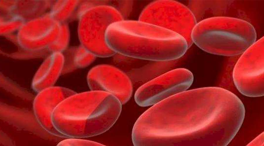 وصفات مميزة لمحاربة فقر الدم