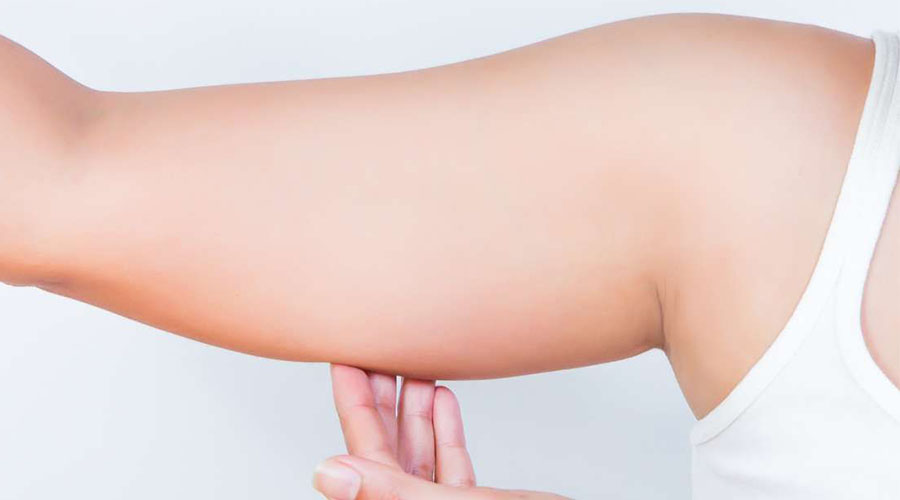Bras mous ? Voici ce que vous devez faire !
